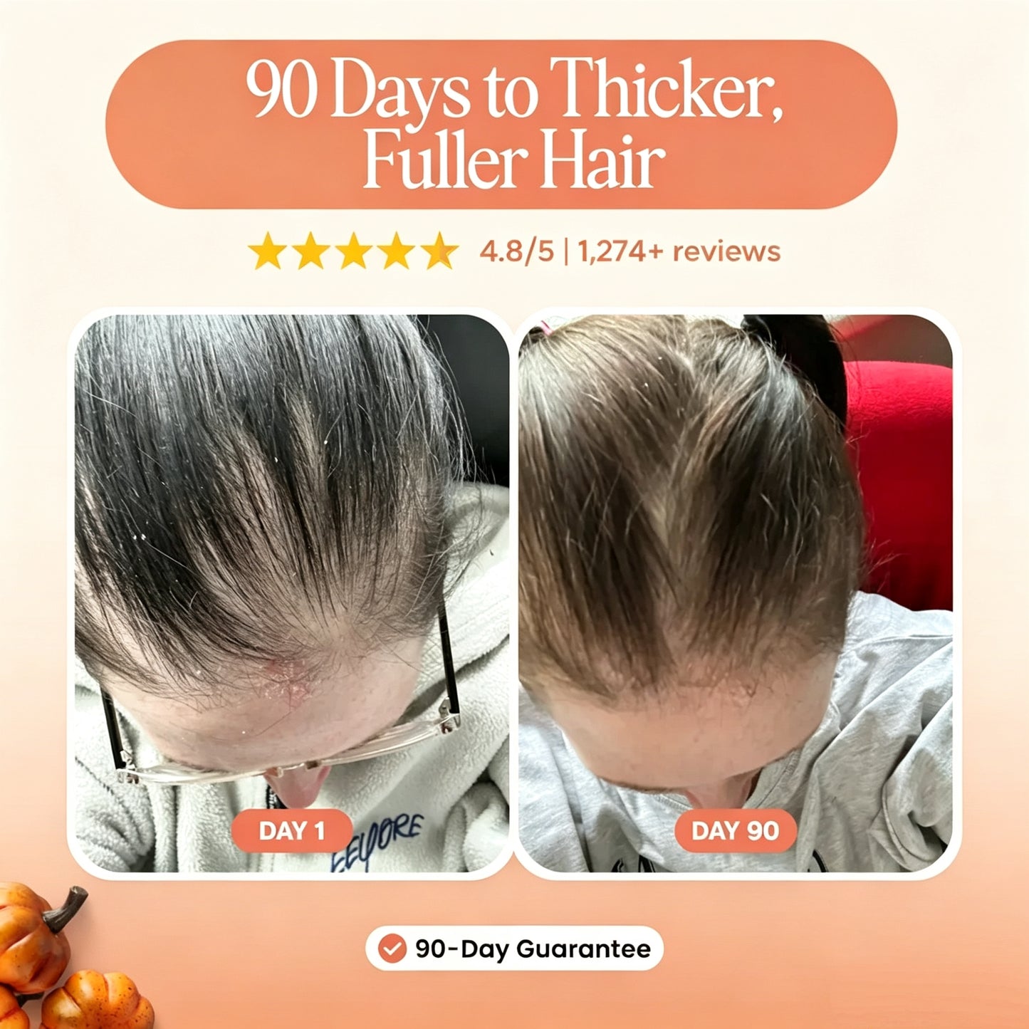Less Shedding in 26 Days or Less